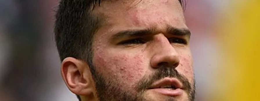 70 milionów za Alissona!